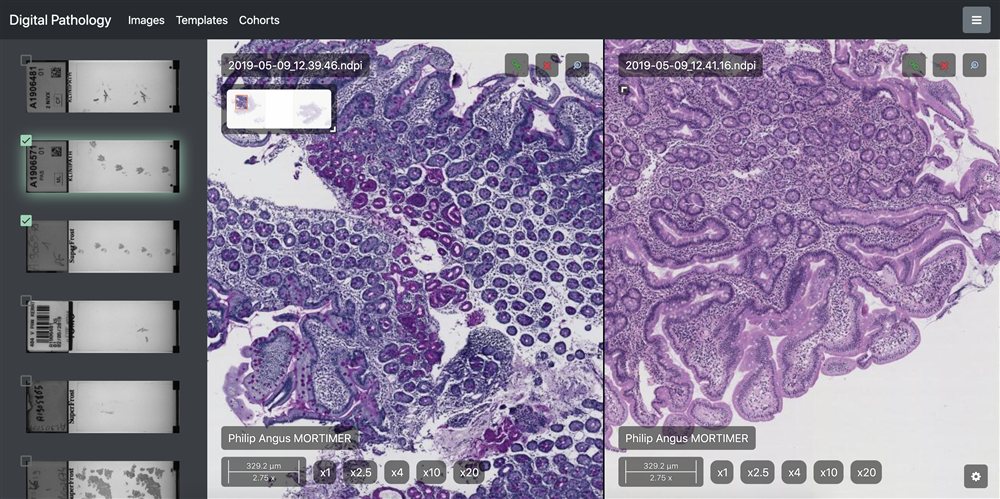 Pathologie digitale
